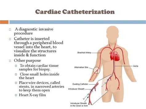 cardiac catheterization and stenting in houston cardiac