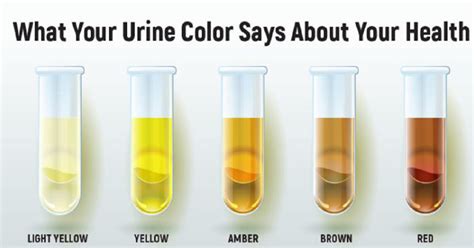 Heres What The Color Of The Urine Says About Your BodyÂ – Filmymantra