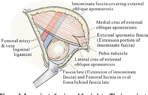 femoral hernia female pictures femoral hernia repair treatment