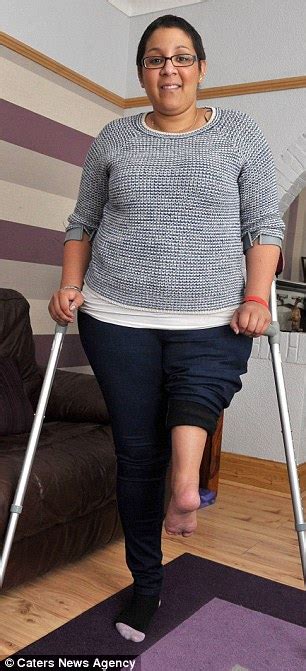 Jordon Moody Who Lost Part Of Her Leg To Cancer Has New