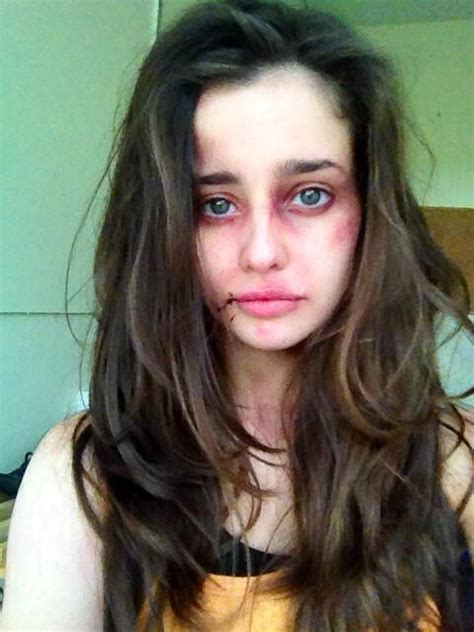 holly earl on twitter you should see the other guy 2h6ksbuumb