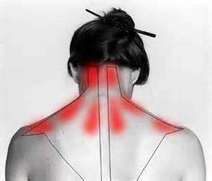 treating  neck muscle strain muscle pull muscle pull