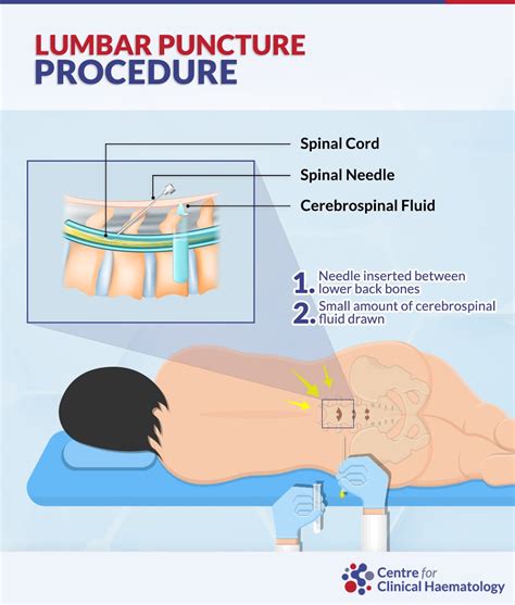 lumbar puncture cfch centre  clinical haematology