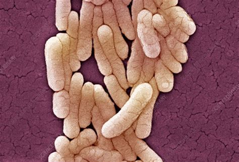salmonella typhimurium bacteria sem stock image