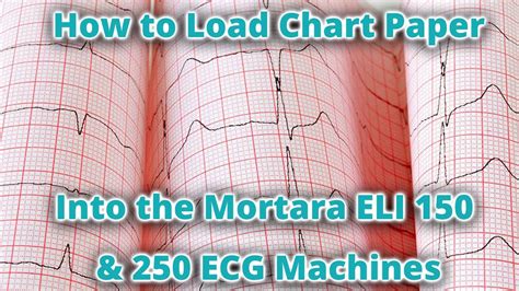 How To Load Chart Paper In The Mortara Eli 150 And 250 Ecg Machines Youtube