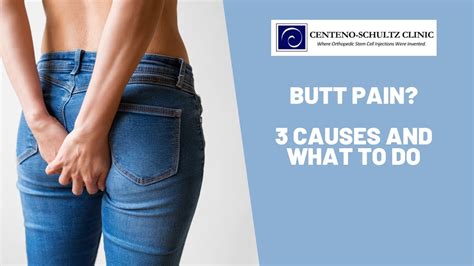 The Top 3 Causes For Butt Pain Regenexx®