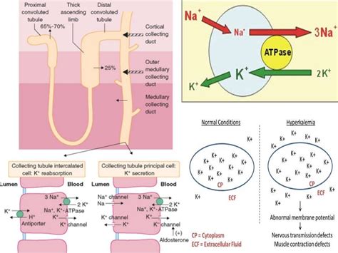 Potassium Disorders Comprehensive And Practical Approach