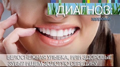 Белоснежная улыбка или здоровые зубы Ищем золотую середину Диагноз
