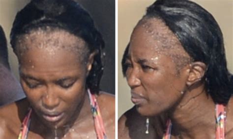 Naomi Campbell S Shocking Bald Patches After Years Of