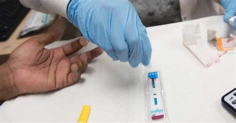 ummc clinic enhances access   hiv testing