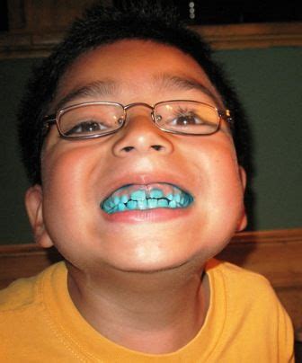 blue teeth dental posts blue fashion  jokes