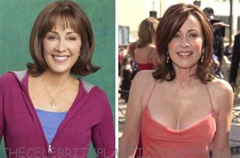 15 Celebrities With The Most Plastic Surgery Sieber