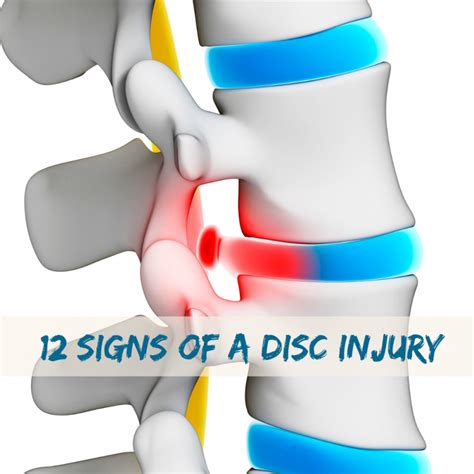 signs   disc injury proback clinics