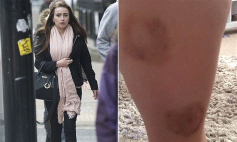 rochdale mother left bite marks on daughter s leg daily mail online