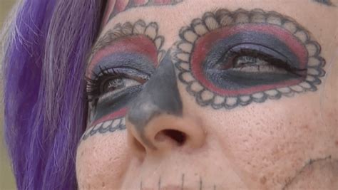 alyssa zebrasky s face tattoo removal journey removery