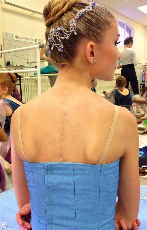 Pin On Back Surgery Recovery
