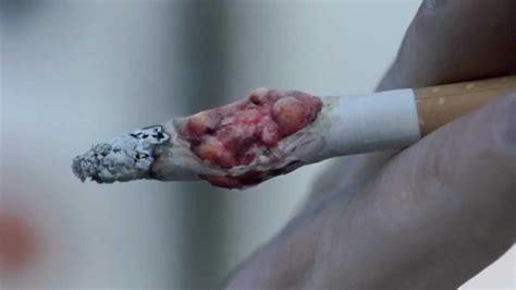 every 15 cigarettes you smoke cause a mutation that can