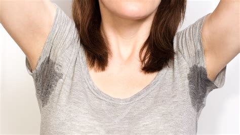 excessive sweating   hyperhidrosis allure