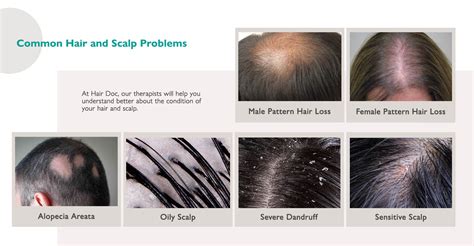 common hair  scalp problems examples solutions hair