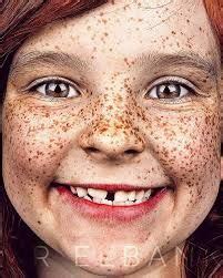 image result  freckles beautiful freckles beautiful smile