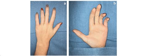 clinical appearance  initial    hand surgery service  scientific