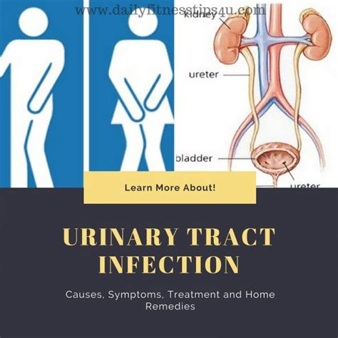 urinary tract infection uti causes symptoms treatment and home