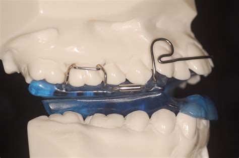 activator orthodontiepraktijk binda  ede