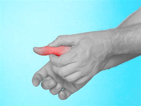 thumb sprain physiotherapy treatment singapore fast pain relief time   fuller life