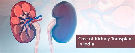 kidney transplant cost  india