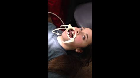 Sister Getting Braces Youtube