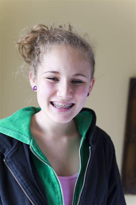 afs 100031 teenage girl wearing braces england britain … alex