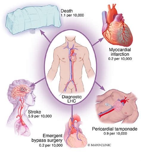 Safety And Risk Of Major Complications With Diagnostic Cardiac