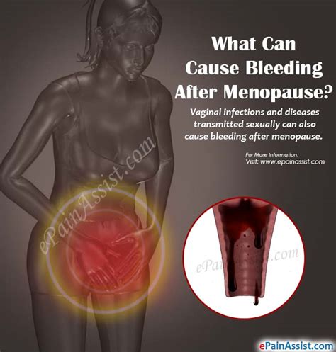 what can cause bleeding after menopause and how is it treated