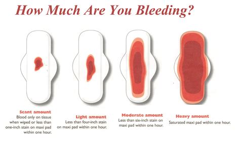 Vaginal Bleeding Spotting In Early Pregnancy The Hot Sex Picture