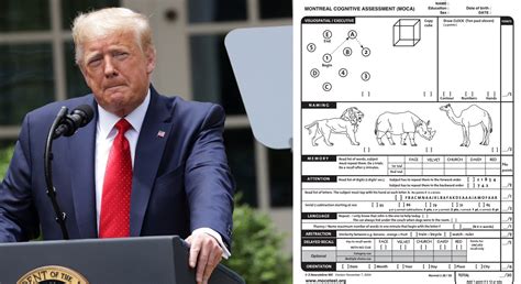 whats   cognitive test  trump brags  aced