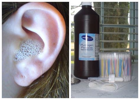 ear spa clean ear wax  ear cleaning wax hydrogen peroxide