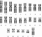 Karyotype Haploid Chromosome Diagrammatical Banding Complement Bands sketch template