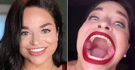 Woman With World S Biggest Mouth Earns £11 000 Per Viral Tiktok Video