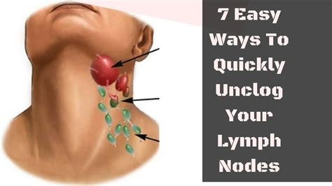 7 Easy Ways To Quickly Unclog Your Lymph Nodes To Reduce Swelling And