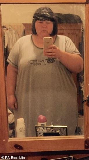 obese mother who would consume 5 000 calories a day sheds half her body