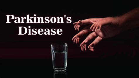 Parkinson S Disease Cure News New Treatment Found In Gene 3 Therapy