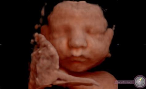 image gallery  bellies ultrasound ddd dhd pregnancy spa