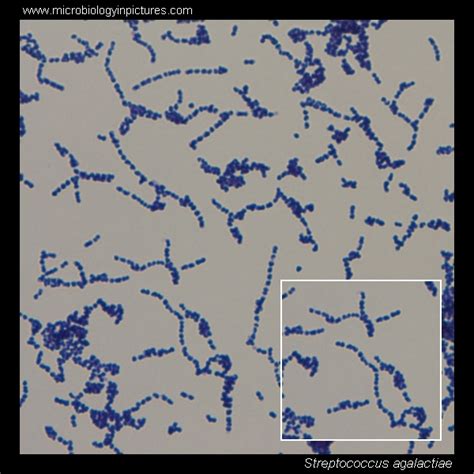 Streptococcus Agalactiae Microscopy Streptococcus