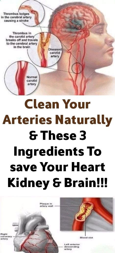 clean  arteries naturally    ingredients  save