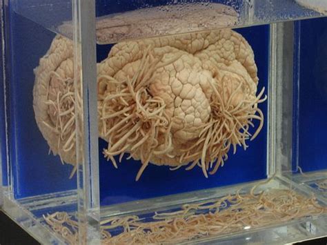 the brain of a dolphin which has suffered from a brain worm parasite veterinarian views