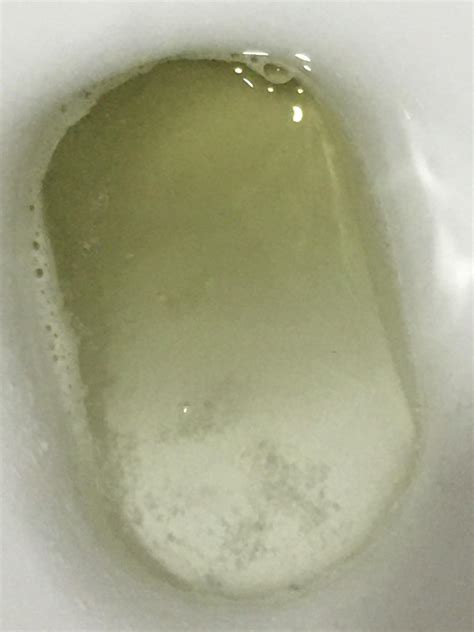 foamy urine       weeks