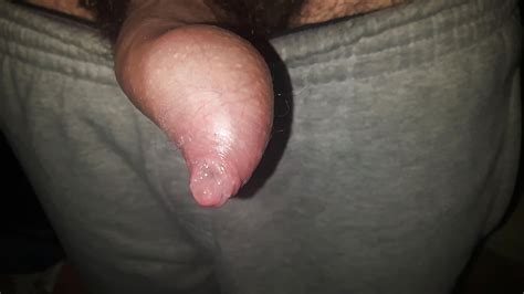 wet foreskin watching porn without cum tight foreskin 2 pics xhamster