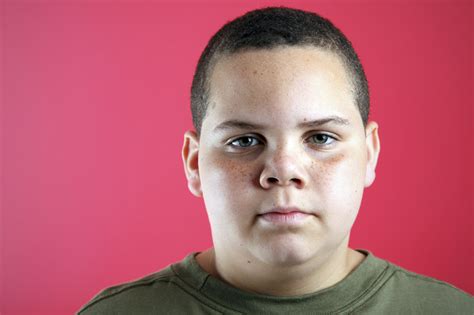 overweight kids   lot  grief heres