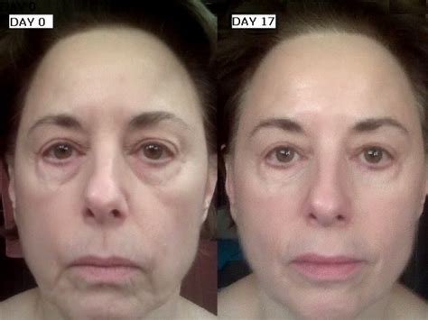 difference demonstrated premium anti aging solutions  galvanic