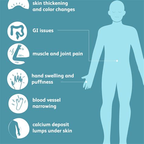 scleroderma signs symptoms  complications